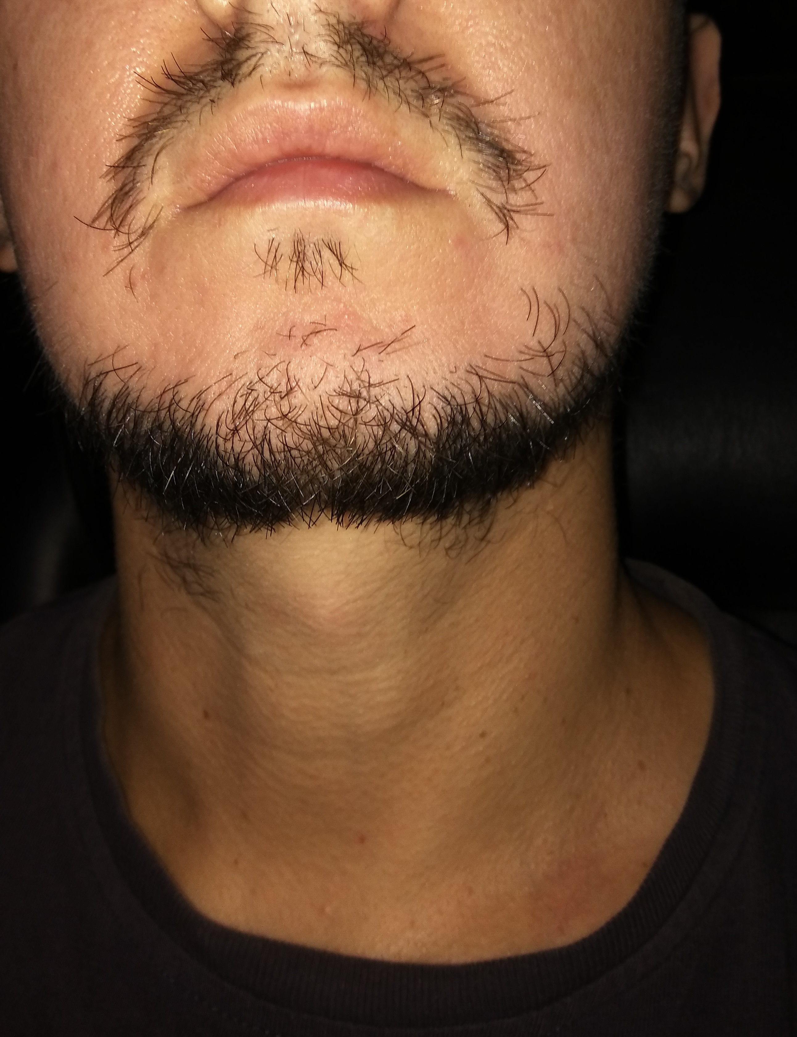 грудь у мужчин на бороде фото 51